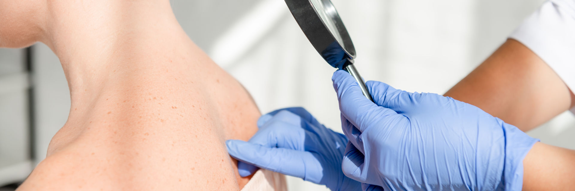 Lipoma Excision